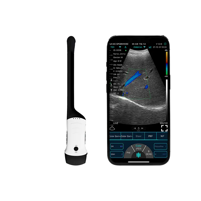 Lo Scanner ad ultrasuoni portatile apre una nuova Era in visita medica