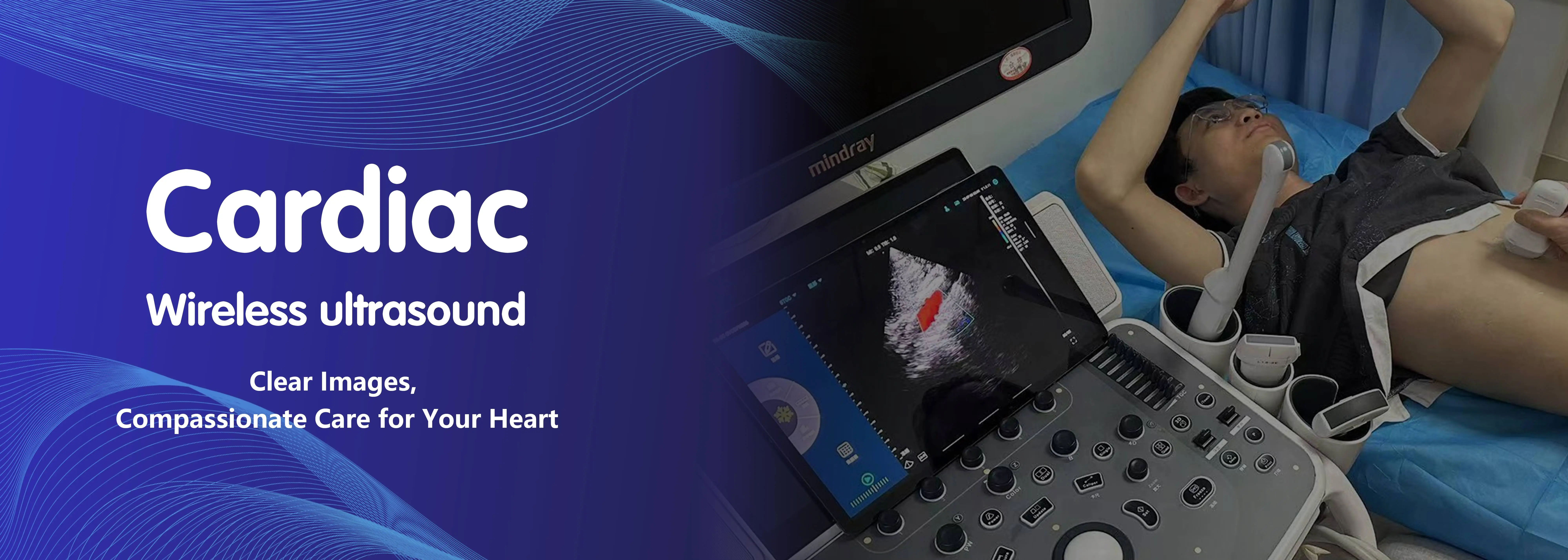 Sonda ecografica wireless cardiaca