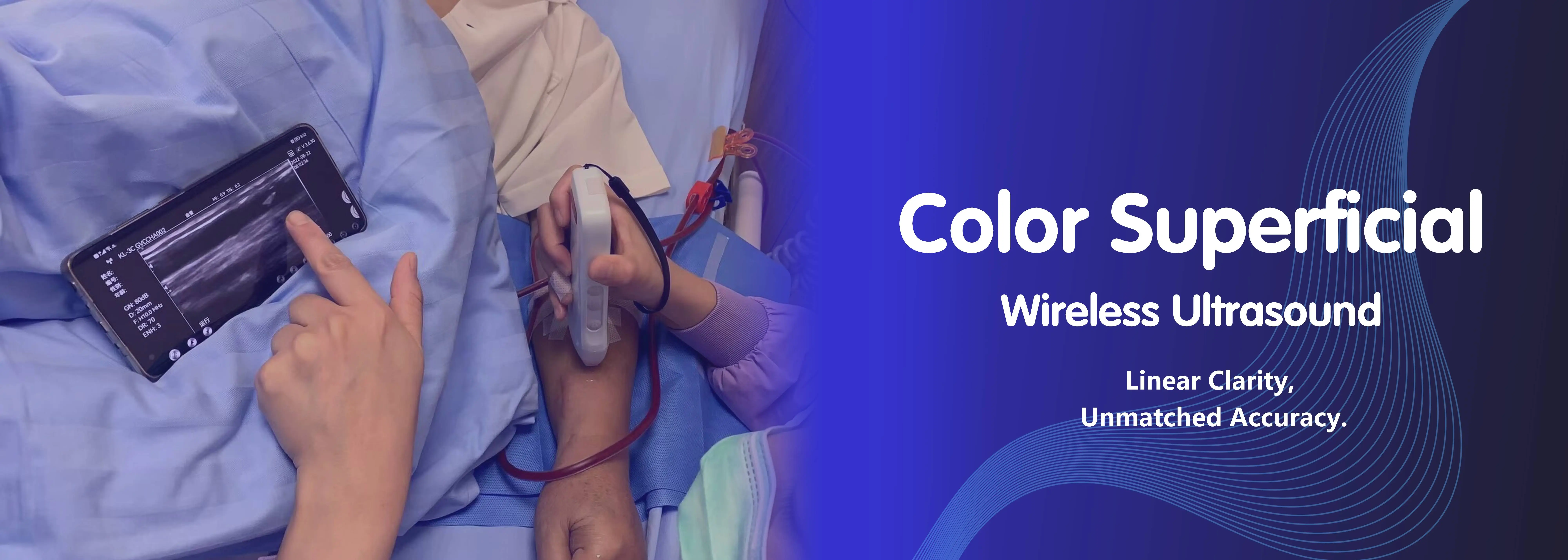 Ecografia superficiale a colori